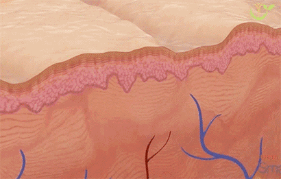 11.gif